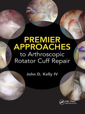 cover image of Premier Approaches to Arthroscopic Rotator Cuff Repair